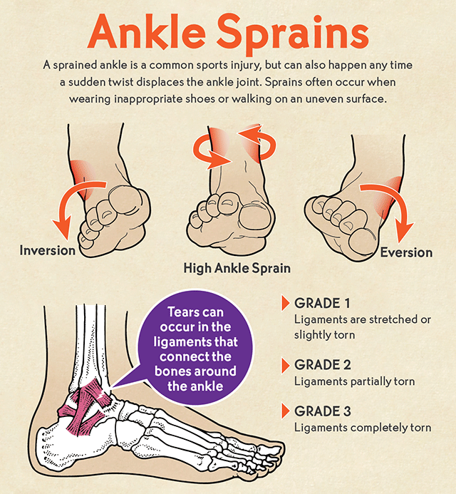 Common Injury for an Athlete Ankle Sprain Boulder County Foot & Ankle